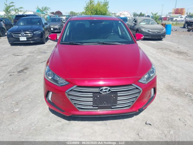 KMHD84LF0JU662684 Hyundai mpi nu