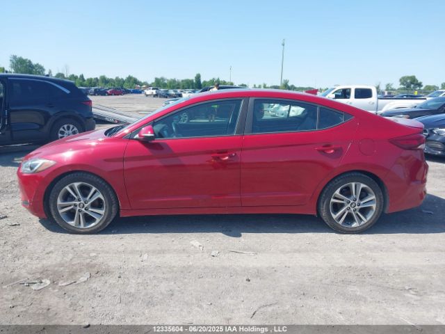 KMHD84LF0JU662684 Hyundai mpi nu