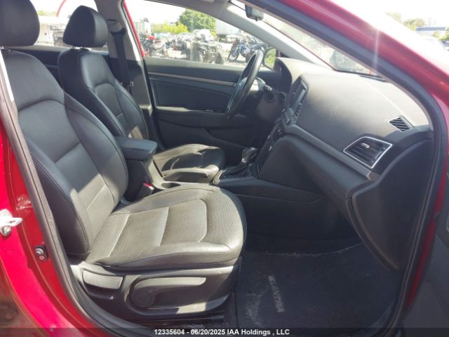 KMHD84LF0JU662684 Hyundai mpi nu