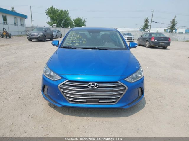 KMHD84LF1HU090860 Hyundai 2017