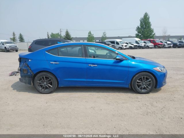 KMHD84LF1HU090860 Hyundai 2017