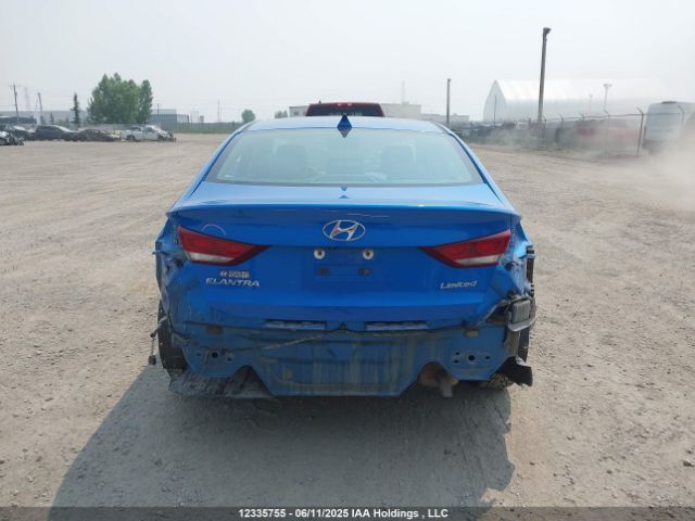 KMHD84LF1HU090860 Hyundai 2017