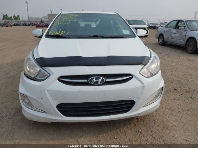 KMHCT4AEXHU183929 Hyundai Accent