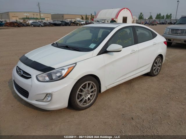 KMHCT4AEXHU183929 Hyundai Accent