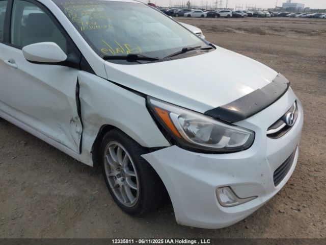 KMHCT4AEXHU183929 Hyundai Accent
