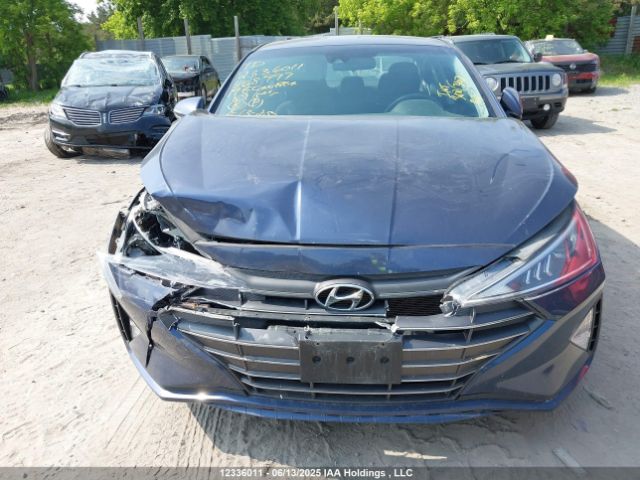 KMHD84LF8KU868997 Hyundai mpi nu
