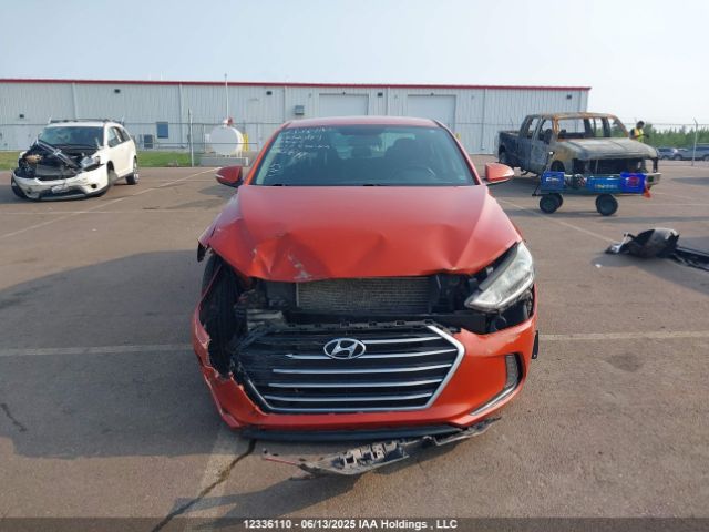KMHD84LF1HU120889 Hyundai Elantra Se/value/limited