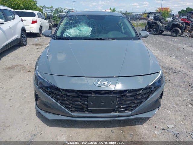 KMHLN4AG7PU378915 Hyundai mpi nu pe