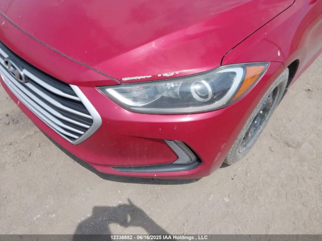 KMHD84LF3HU174999 Hyundai ELANTRA GL