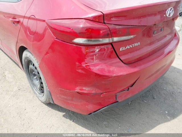 KMHD84LF3HU174999 Hyundai ELANTRA GL