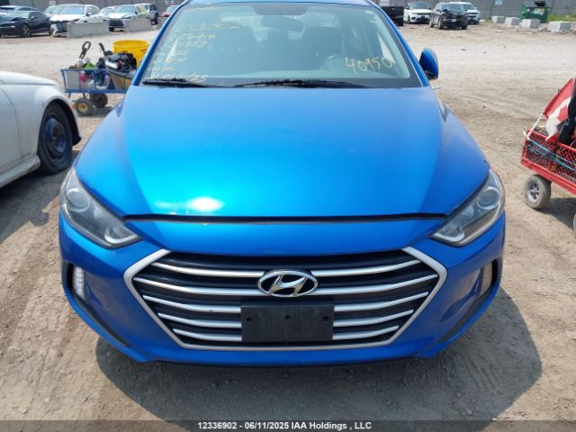 KMHD84LF1JU511353 Hyundai mpi nu