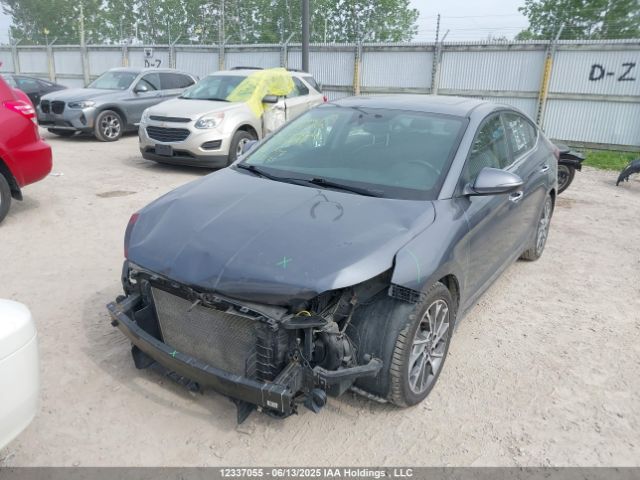 KMHD84LF9LU920638 Hyundai mpi nu