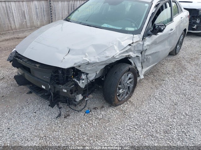 KMHLM4DG3RU648787 Hyundai mpi nu pe