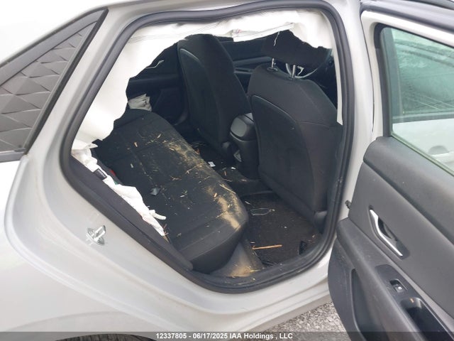 KMHLM4DG3RU648787 Hyundai mpi nu pe