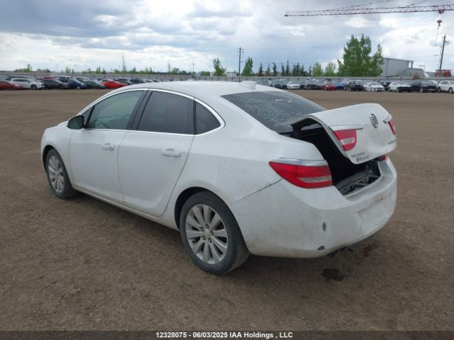 1G4P15SK0G4103621 Buick Verano