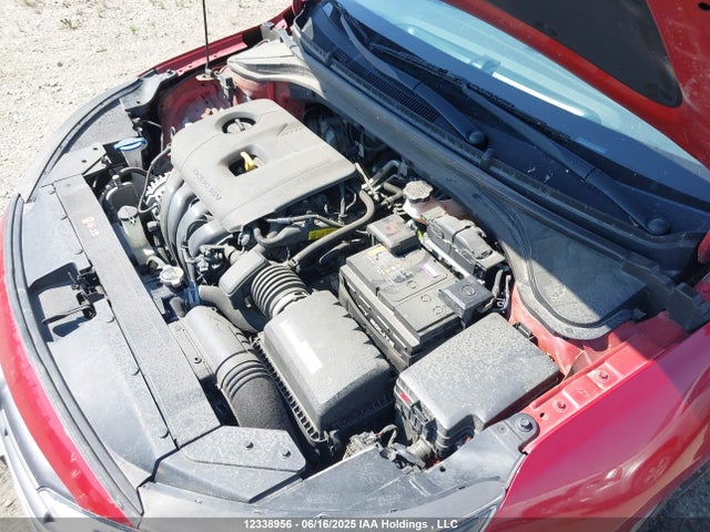 KMHD84LF4KU790072 Hyundai Elantra Sel/value/limited