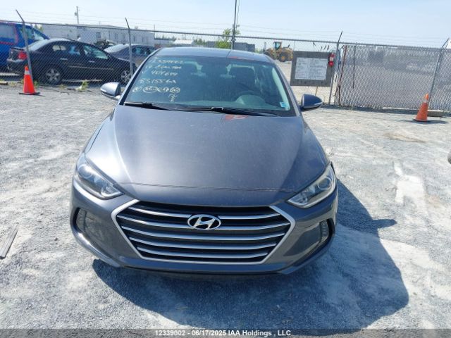 KMHD84LFXHU404649 Hyundai 2017