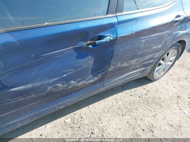 KMHDH4AE6GU530371 Hyundai Elantra Sport Appearance