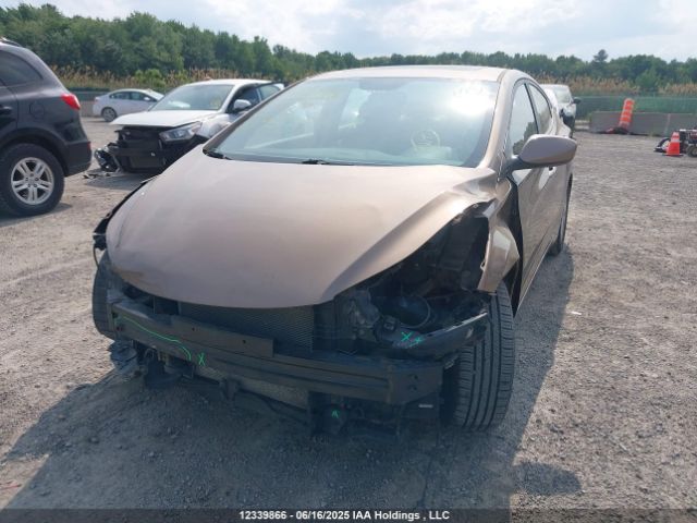 KMHDH4AEXFU355802 Hyundai dohc mpi nu