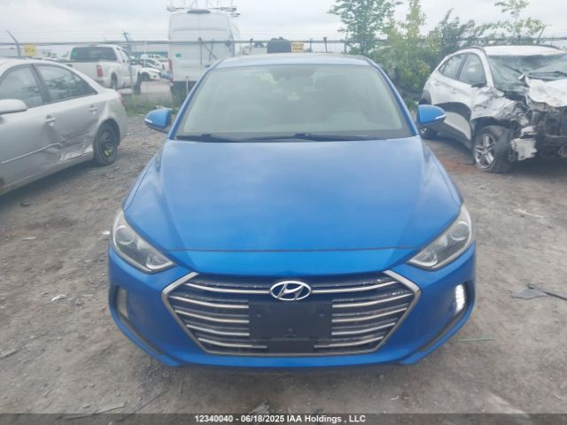 KMHD84LF1JU605748 Hyundai mpi nu