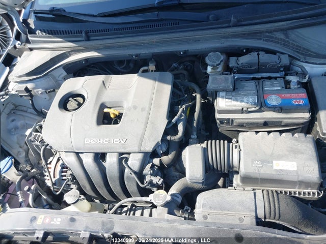 KMHD84LF2HU321281 Hyundai 2017