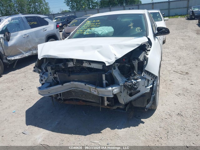 1G4PN5SK6E4171262 Buick lea