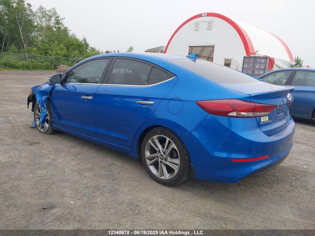 KMHD84LF0HU315995 Hyundai 2017
