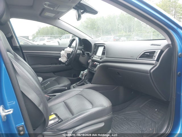 KMHD84LF0HU315995 Hyundai 2017
