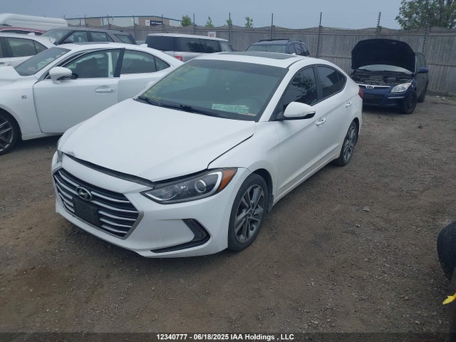 KMHD84LFXHU175034 Hyundai 2017