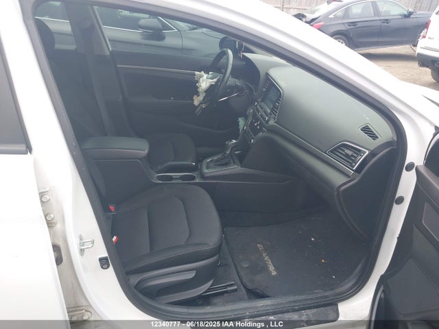 KMHD84LFXHU175034 Hyundai 2017