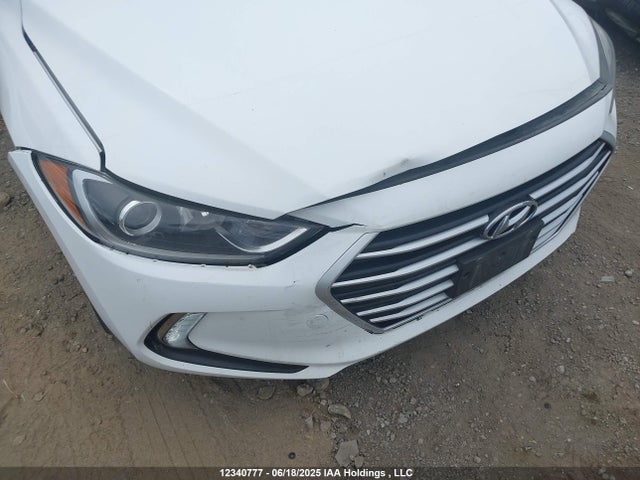 KMHD84LFXHU175034 Hyundai 2017