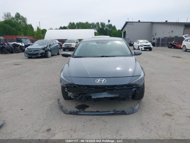 KMHLM4AG0PU439606 Hyundai mpi nu pe