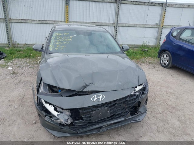 KMHLM4AG9PU414140 Hyundai mpi nu pe