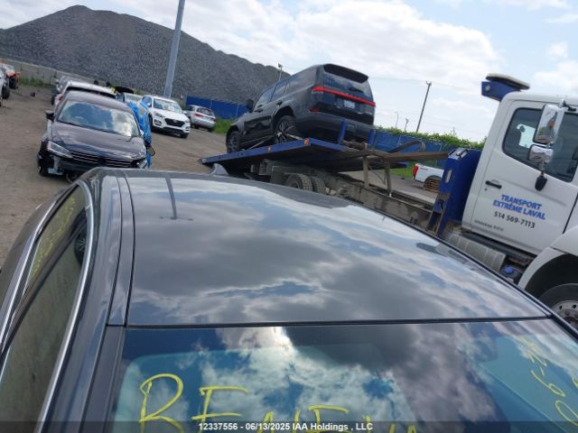 1G4P15SK0H4113499 Buick Verano
