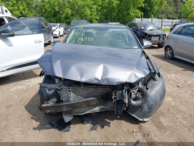 KMHD84LFXJU679413 Hyundai mpi nu