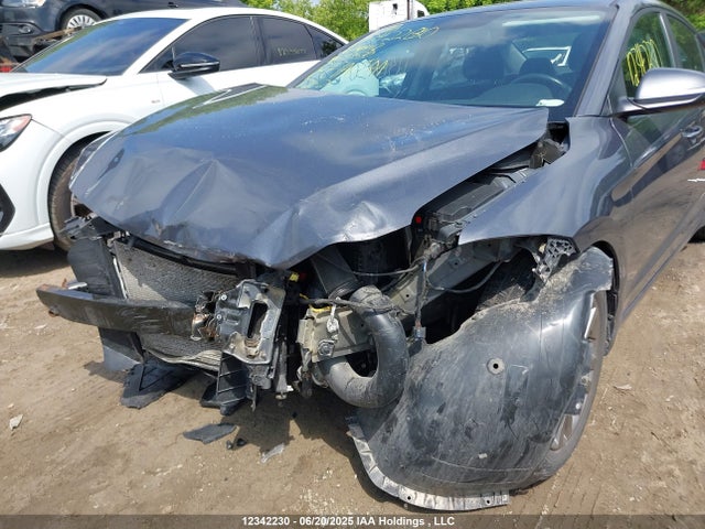 KMHD84LFXJU679413 Hyundai mpi nu