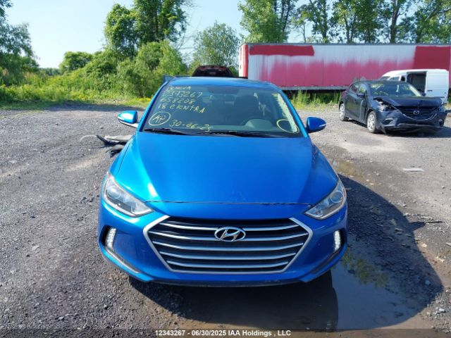 KMHD84LF3JU658208 Hyundai mpi nu