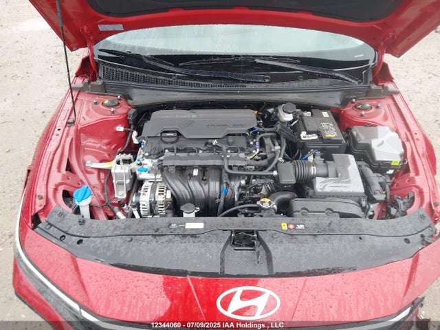 KMHLM4DG7SU967406 Hyundai mpi nu pe