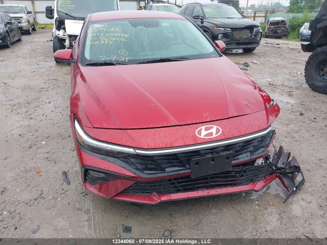 KMHLM4DG7SU967406 Hyundai mpi nu pe