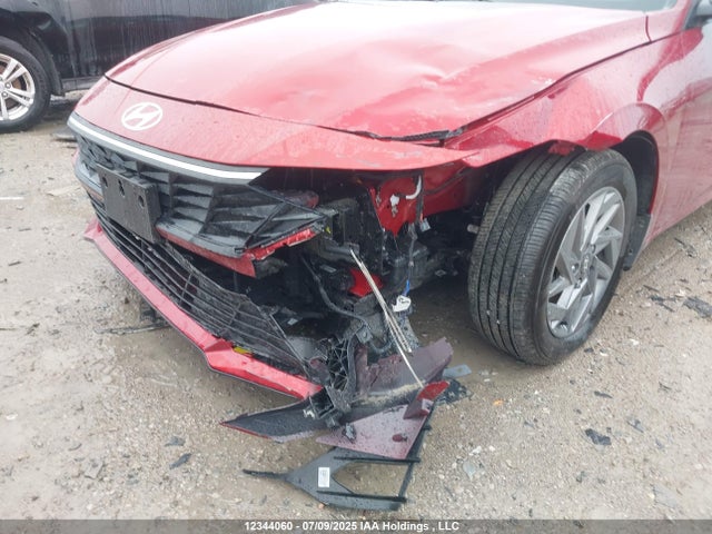 KMHLM4DG7SU967406 Hyundai mpi nu pe