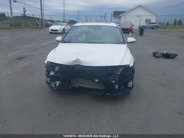 KMHLM4DG9RU669885 Hyundai mpi nu pe