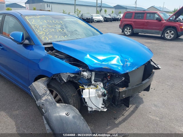 KMHD84LF1JU602302 Hyundai mpi nu