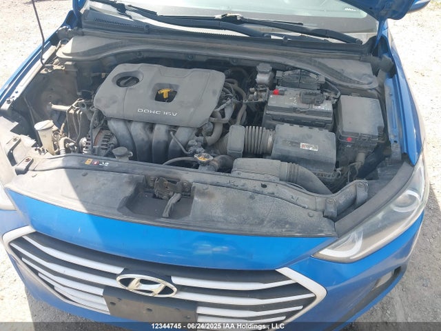 KMHD84LF5JU512683 Hyundai mpi nu