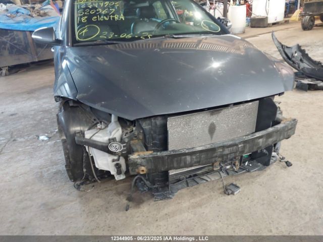 KMHD84LF4JU520967 Hyundai mpi nu