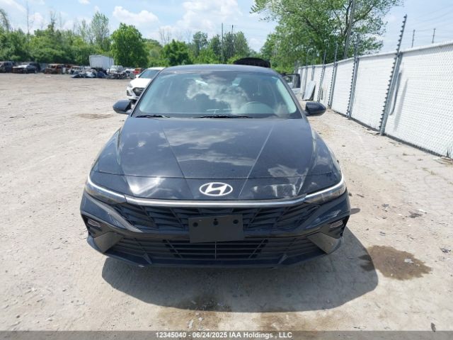 KMHLM4DG3SU900396 Hyundai mpi nu pe