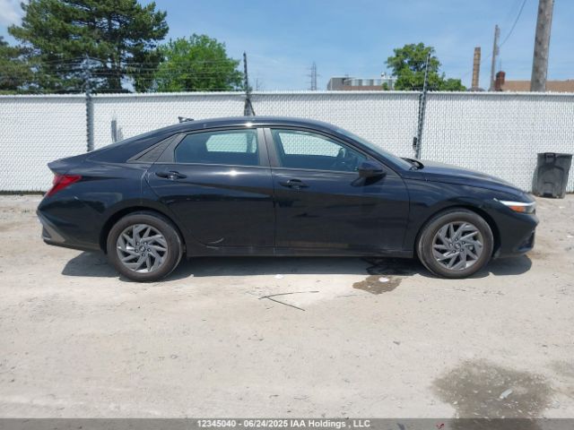 KMHLM4DG3SU900396 Hyundai mpi nu pe