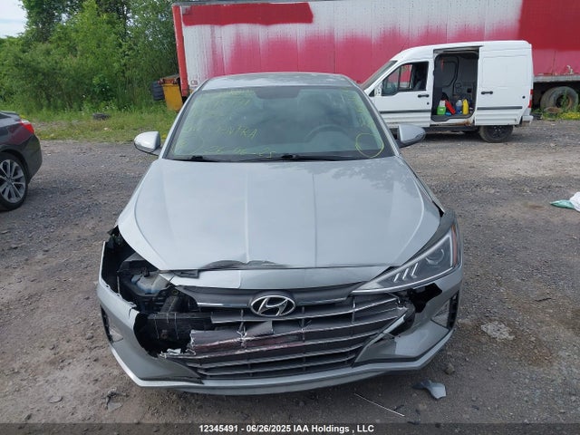 KMHD84LF5LU967942 Hyundai mpi nu