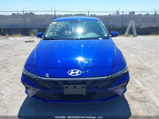 KMHLM4DG2RU767592 Hyundai mpi nu pe