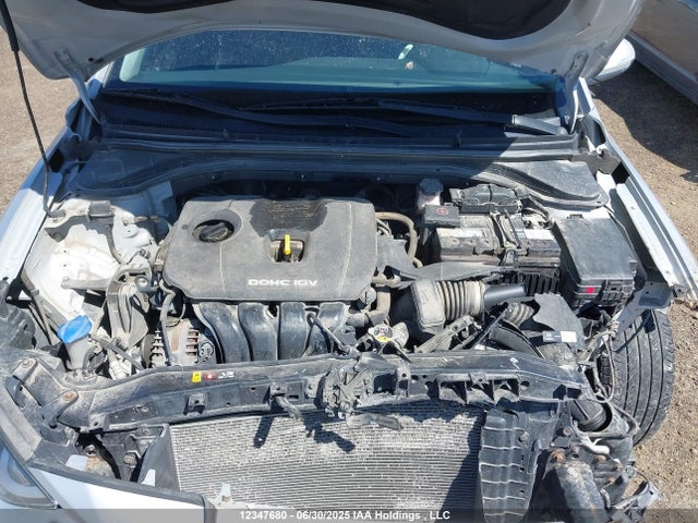 KMHD84LF4HU087144 Hyundai 2017
