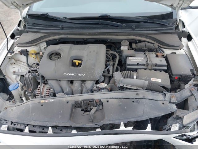 KMHD84LFXHU092350 Hyundai 2017